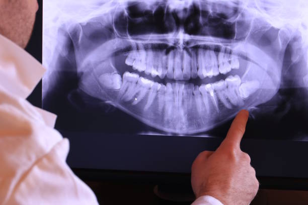 Best Emergency Tooth Extraction in Forestbrook, SC