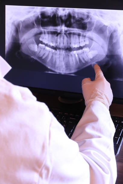 Best Emergency Tooth Extraction in Forestbrook, SC