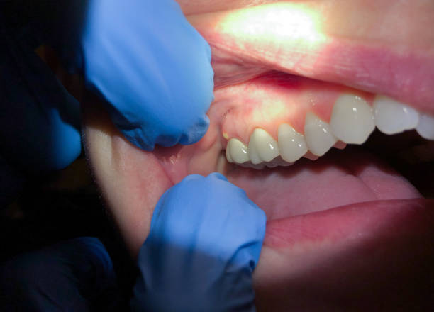  Forestbrook, SC Emergency Dentist Pros