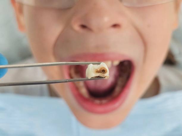 Best Same-Day Emergency Dental Services in Forestbrook, SC