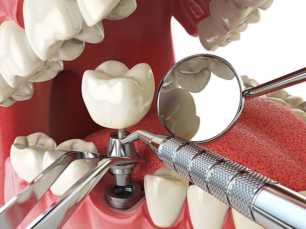 Best Emergency TMJ Treatment in Forestbrook, SC